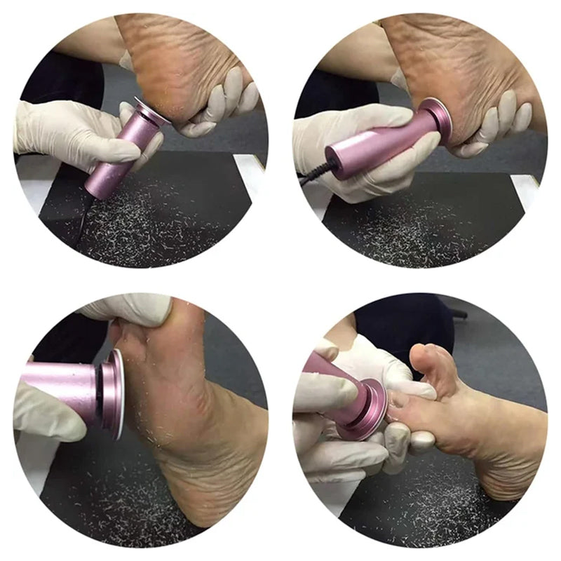 SmoothFeet Pro – Voor zijdezachte voeten in een handomdraai